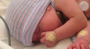 2016-08-30_lily-rectangle-preview